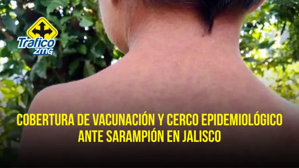 Aumento de Casos de Sarampión en Jalisco: Un Llamado a la Vacunación