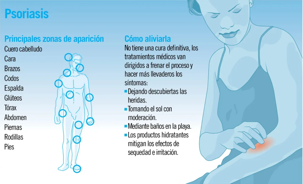 Psoriasis: Comprendiendo sus Causas, Síntomas y Tratamientos Efectivos