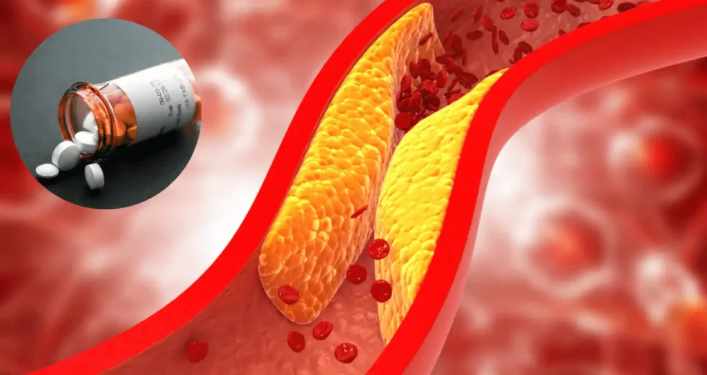Un Avance Prometedor en el Tratamiento del Colesterol LDL