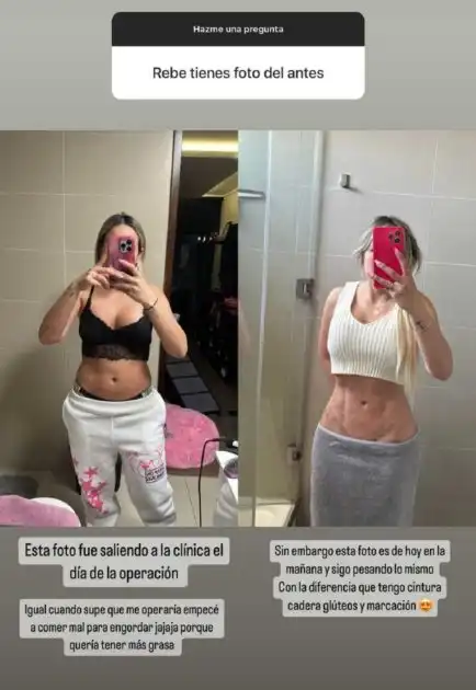 La Transformación de Rebeca Naranjo: Cirugía Estética y Recuperación