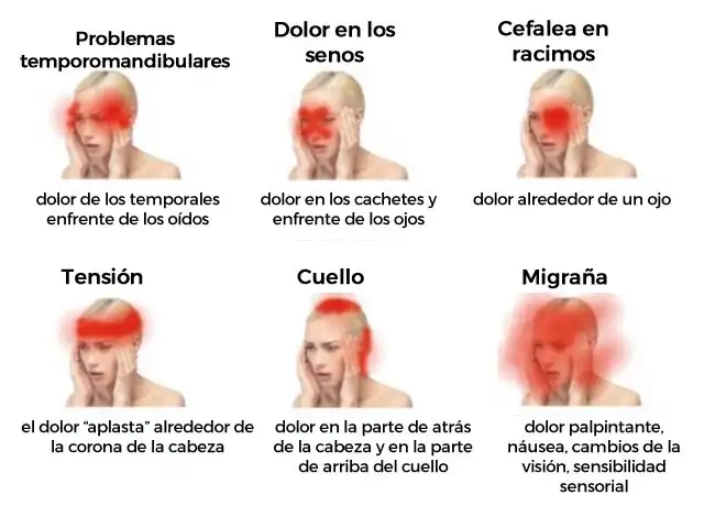 Entendiendo el Dolor de Cabeza: Causas y Soluciones Efectivas