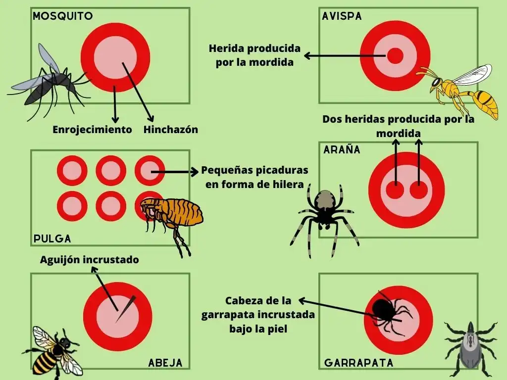 Guía Práctica para Manejar Picaduras de Insectos en Verano